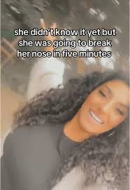 Disaster waiting to happen 😭 #fyp #trampolinefail #brokennose #rhinoplasty  #toronto