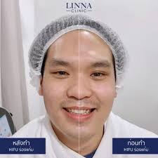 ลินนา คลินิก