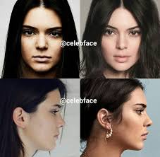 Kendall jenner (born on november 3, 1995) is a model who appeared in the reality tv show keeping up with the kardashians. after working in commercial print ad campaigns and photoshoots. Ich Sehe Lippeninjektion Augenbrauenlifting Nasenjob Kinnimplantat Fuller Komm Schon Keine Plastische Chirurgie Augenbrauen Liften Plastische Chirurgie Schonheitstricks
