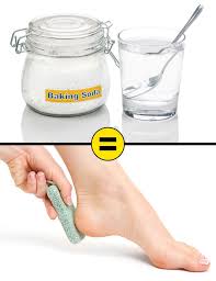 Share a gif and browse these related gif searches. 10 Home Remedies To Remove Cracked Heels And Get Beautiful Feet