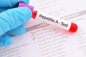Hepatitis A Outbreak Update American Nurse Today