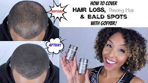 Straight hair parts can enhance the appearance of thinning hair. How To Cover Up Hair Loss Thinning Hair And Bald Spots W Gofybr Biancareneetoday Youtube