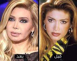 قبل أيام من رفع قيود إجراءات السلامة تماما في إنجلترا، أعلن وزير الصحة البريطاني أنه مصاب بالفيروس. ØµÙˆØ± Ù†Ø¬Ù…Ø§Øª ØªØ´ÙˆÙ‡Ù† Ø¨Ø¹Ø¯ Ø¹Ù…Ù„ÙŠØ§Øª Ø§Ù„ØªØ¬Ù…ÙŠÙ„ Ù†Ø³ÙˆØ© ÙƒØ§ÙÙŠÙ‡