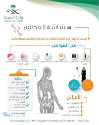 أخبار 24 الصحة تعر ف بمرض هشاشة العظام أسبابه وأعراضه وطرق الوقاية منه