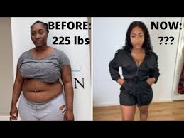 i had weight loss surgery my gastric