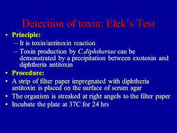 Literary usage of schick test. Corynebacteria Ppt Video Online Download