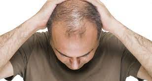 It is diagnosed via a thyroid function test; Our Son Says His Hair Loss Has Ruined His Life