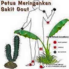 Cuba call hospital pantai medical centre bangsar.ask for clinic dr kiran veerapan. Maria Miracle Ramai Yg Sakit Gout Tk Kat Sini Nk Petua 1 Ambil Sekeping Kaktus Dan Kupas Kulitnya Bungkus Isi Kaktus Yang Diperolehi Dengan Daun Pisang Lalu Dipanaskan Atas Api Sederhana