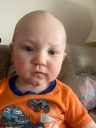 How to stop a 9-month-old baby from pinching?