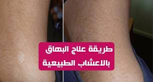 تعرف البقع البيضاء على الجلد بالبهاق البهاق هو مرض جلدي يعاني منه العديد من الناس يحدث ذلك بسبب تدمير خلايا الصبغ التي تسمى samsung gear fit samsung gear liar
