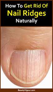 Nail Ridges Nail Ridges Lines On Nails Cure Nails
