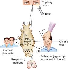 Image result for Coma Exam