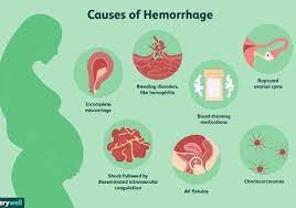 Spotting during pregnancy can occur due to vaginal infections, sexual intercourse, antepartum hemorrhage, ectopic pregnancy or a miscarriage. How To Know If You Re Hemorrhaging Due To A Miscarriage