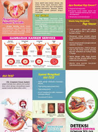 Laflet Iva Pap Smear Lanjutan