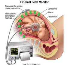 Image result for Contraction Stress Test