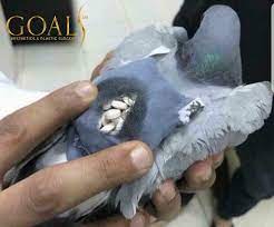 297 likes · 113 talking about this · 26 were here. Goals Plastic Surgery On Twitter What S Better Spending Money On Pills Or Butts We Vote For Butts 1 833 Goals Ny Https T Co 9agsqvn7hm Snapchat Goalssurgery Twitter Goalsaesthetics Facebook Goals Plastic Surgery