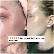 Oct 31, 2019 · for maintaining an even skin tone, you need to build a skincare routine that focuses on both smoothing out the texture of your skin as well as treating and preventing hyperpigmentation (dark. 23 Products Designed To Help You Get A More Even Skin Tone