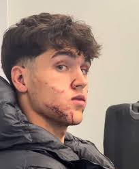 Fredo Martinez : Kobarsi devrait pouvoir jouer dimanche… voir plus