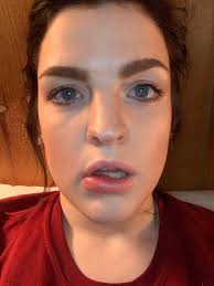 Experiences with painful plastic objects