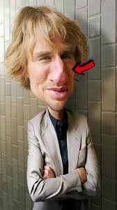 Wilson Odobert Injury