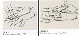 Since fdp is the major muscle for hand gripping power, dynamometer (handgrip ergometer) can be used for measuring the hand gripping strength. Ortho 2 Hand Wrist Flashcards Quizlet