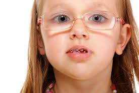 Normal children usually stop drooling by two years of age. Seven Tips To Stop Your Child With Special Needs From Drooling Friendship Circle Special Needs Blog Friendship Circle Special Needs Blog
