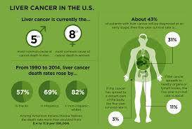 Liver Cancer On The Rise Cancer Today