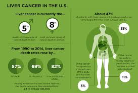 liver cancer on the rise cancer today