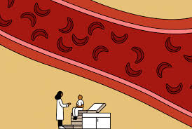 Sickle cell disease (scd) is a group of inherited red blood cell disorders. One Doctor S Approach To Treating People With Sickle Cell Disease Commonwealth Fund