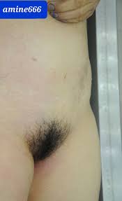 Examination a nude dead corps of ugly Chinese women | theYNC