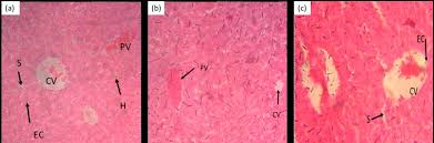 Image result for Erythrina sacleuxii