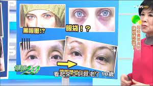 消黑眼圈 眼袋這樣吃 讓眼睛變年輕 健康2 0 完整版 youtube eye treatments health make it yourself