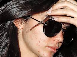 People who liked kendall jenner's feet, also liked 15 Latest Kendall Jenner Without Makeup Images Styles At Life Kendall Jenner Without Makeup Kendall Jenner Acne Kendall Jenner Eyebrows
