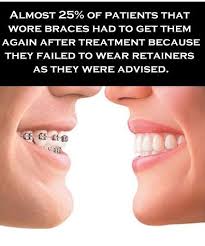 Your Teeth Will Move If You Don T Wear Your Retainers Retainers Dental Fun After Braces