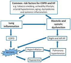 Image result for COPD Management