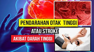 Pendarahan Otak Atau Stroke Akibat Darah Tinggi Movie Posters Movies Poster