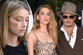 After filing the papers heard was given a temporary restrainer order against. Witnesses In Johnny Depp S 50m Amber Heard Lawsuit Deny She Had Injuries Mirror Online