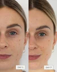 I have no idea why I haven't started looking after my skin like this  before! Thank you Sonya, my skin feels and looks amazing!”