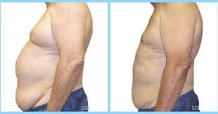 Pin On 10 Pound Challenge