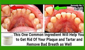 It can help prevent the buildup of plaque but is also an effective method of removing the plaque that regular brushing can not deal with. Pin On Home Remedies
