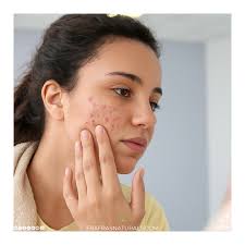 Eczema vs Psoriasis: What your skin might be telling you Dr. Freida Lewis-Hall  joins “The Dr's” to explain what the difference is between eczema and  psoriasis and shares what these conditions may