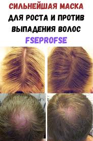 маска от выпадения волос в домашних условиях самая эффективная Silnejshaya Maska Dlya Rosta I Protiv Vypadeniya Volos Volos