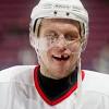 Let's look at the 22 worst teeth in nhl. 1