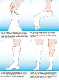 Use And Application Of Graduated Elastic Compression Stockings