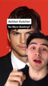 Ashton Kutcher 🛑 👩‍🦲#fyp #fitness #fighthairloss #viral