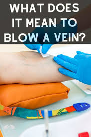 What Does It Mean To Blow A Vein In 2020 Nerdy Nurse Veins Nursing Profession