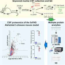 Image result for CSF Protein