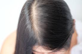 Alors on pense au carré plongeant ou au carré strict. Cheveux Fins Et Ongles Cassants J Ai Teste Les Supplements De Biotine Et Voici Ce Qui S Est Passe