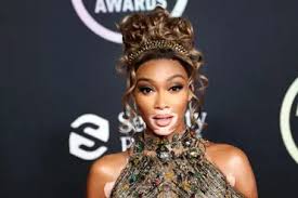 Image result for robert zaruba vitiligo