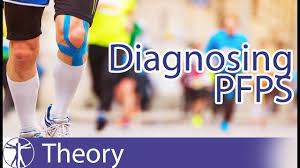 Patellofemoral Pain Syndrome Diagnosis Youtube